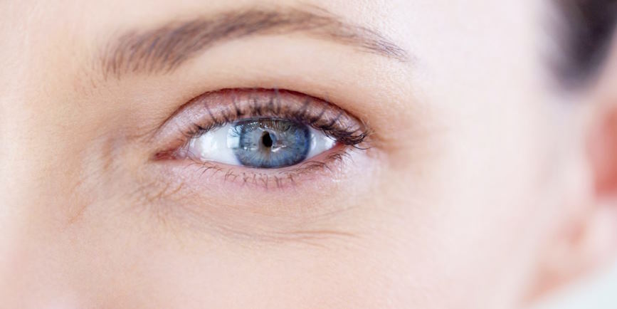 eliminate crows feet